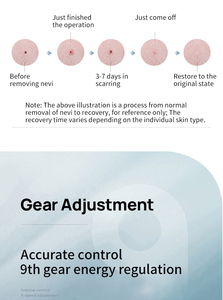 Instrument Portable d'Élimination des Taches Machine de Cautérisation Électrique Dispositif d'Élimination des Grains de Beauté Stylo de Détouage de la Mélanine - Product Image 3