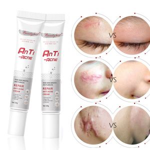 Crème anti-acné et anti-taches à l'extrait de plantes Beauty Host, vente en gros, soin du visage personnalisé, crème anti-acné pour le visage - Product Image 1