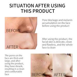 Marchio privato OEM Custom Centella asiatica idratante anti rughe schiarente poro raffinazione anti acne viso siero - Product Image 5