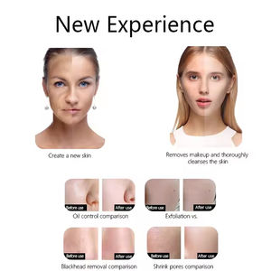 Espátula Facial Sónica Portátil para Limpieza de Poros, Eliminación de Puntos Negros y Exfoliación Profunda de la Piel - Product Image 5