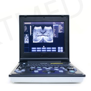 Mesin USG <span class=keywords><strong>Digital</strong></span> BW Portabel KT-A027 untuk Penggunaan Kehamilan, Ekografi, dan Ekokardiografi - Product Image 5