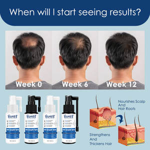 Best-seller - Huile capillaire réparatrice pour cheveux secs et abîmés, 100% pure et biologique, enrichie en caféine, favorisant la croissance des cheveux - Product Image 3