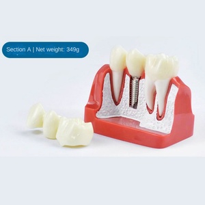 Oral Teaching Simulation Model Plastic Dental Implant with Removable <b>Teeth</b> Multi-Purpose <b>Teeth</b> <b>Whitening</b> Accessories - Product Image 2