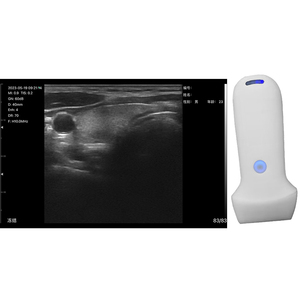Appareil Suresult 4D et scanner à ultrasons sans fil <span class=keywords><strong>de</strong></span> <span class=keywords><strong>poche</strong></span> B <span class=keywords><strong>Doppler</strong></span> couleur - Product Image 4