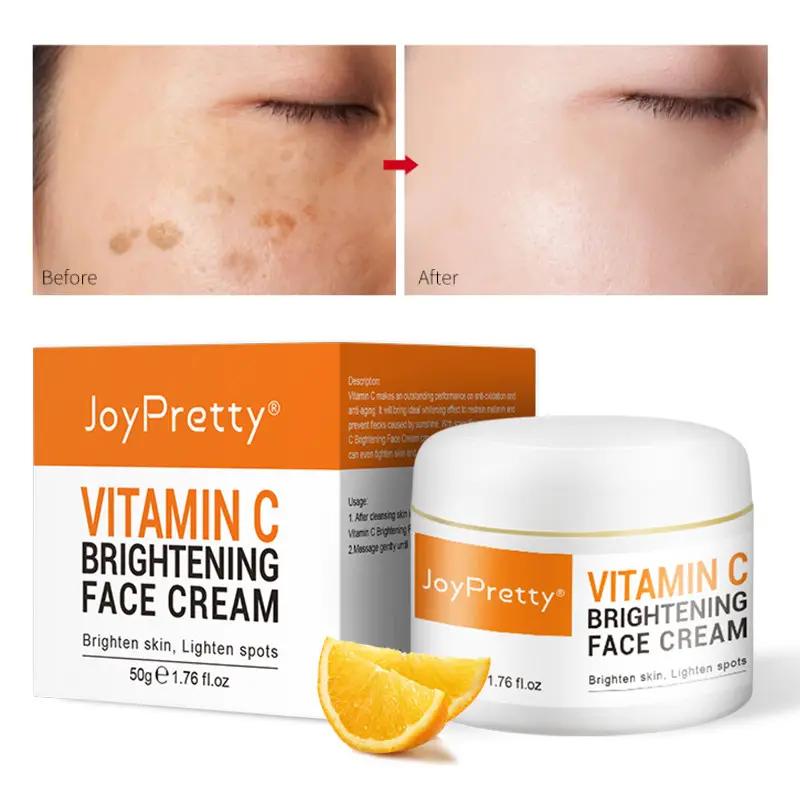 Creme facial clareador, removedor de manchas escuras, creme de sardas e melanina para cuidados com a pele, clareamento, vitamina c