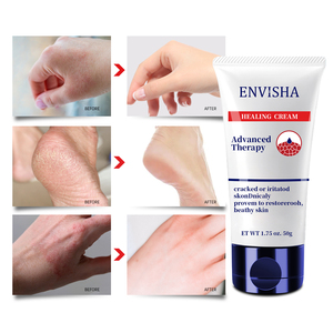 Crema unguento curativo idratante da viaggio per pelle screpolata tacchi secchi per le mani - Product Image 2