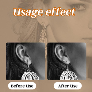 Protezione per lobi auricolari in Silicone Premium-supporto per orecchini ipoallergenici per Piercing post-cura che protegge il lobo dell'orecchio - Product Image 4