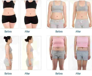 Máquina de Presoterapia 3 en 1 para Drenaje Linfático de Cuerpo Completo - Product Image 6