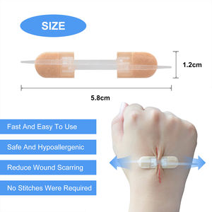 Transparente Zip ponto suturas Kit ataduras com zíper borboleta pele cirúrgica ferida encerramento dispositivo Band Aid Patch - Product Image 4
