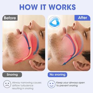 プロのいびき防止マウスピース、ソフトないびき防止マウスガード、自宅や旅行に便利な快適な歯科用いびき軽減器具 - Product Image 6