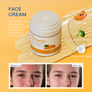 गर्म बिक्री सौंदर्य मॉइस्चराइजिंग सफेद हल्दी फेस क्रीम को हटाने के लिए सफेद हल्दी फेस क्रीम - Product Image 2