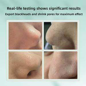 La pulizia profonda della striscia di bambù del naso del carbone si restringe poro rimuovi la testa nera a base di erbe vegani trattamenti di cura della pelle per tutta la pelle degli adulti - Product Image 6