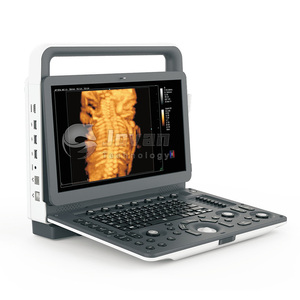 Ecógrafo Veterinario Portátil Totalmente Digital J-C600 para Perros y Gatos, Doppler Color para Cardiología y Obstetricia - Product Image 3