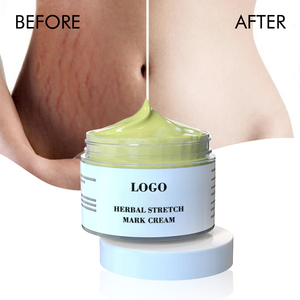 Crème réparatrice pour le corps au beurre de karité biologique, marque privée OEM, pour les vergetures et les cicatrices de <span class=keywords><strong>grossesse</strong></span> - Product Image 5