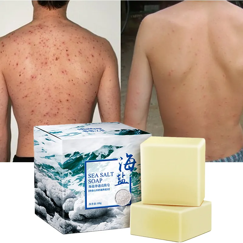 Sapone per il corpo del viso schiarente della pelle dell'acne che fa rifornimenti sapone organico naturale del bagno delle mani che imbianca sapone fatto a mano del sale marino dell'himalaya