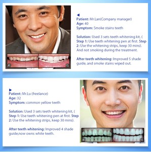 Kit de bandes de blanchiment des <span class=keywords><strong>dents</strong></span> recommandées par <span class=keywords><strong>les</strong></span> dentistes à saveur de menthe 6% HP - Product Image 4