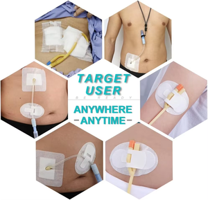 อุปกรณ์ยึดสายสวนป้องกันการลื่น ติดแน่นในตัว ช่วยรักษาความเสถียรของสายสวน - Product Image 6