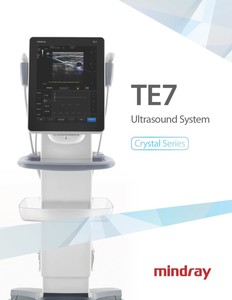 Máquina de Ultrasonido Doppler a Color TE7 Más Vendida para Uso Veterinario con Función Estable - Product Image 5