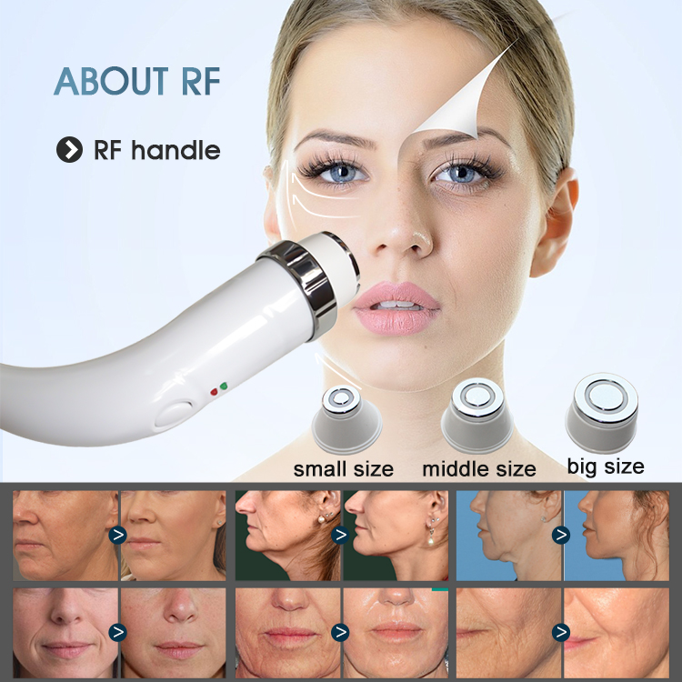 4 in 1 laser machine