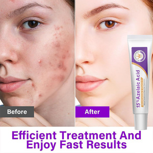 Crema Facial con Nicotinamida, Vitamina C al 12% y Ácido Azelaico para Eliminar Marcas de Acné, 50 ml, para Piel Sensible, de Día - Product Image 5