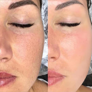 Venta al por mayor Stayve BB Cream Booster Esencia para blanquear la piel Semipermanente BB Foundation <span class=keywords><strong>Pigment</strong></span> Bb Booster Starter Kit - Product Image 3