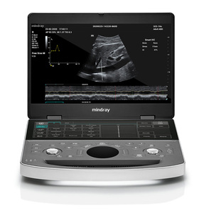 Ecógrafo Doppler Color Mindray Serie ME8 ME, Instrumentos de Ultrasonido Médico para Uso Veterinario en Hospitales/Clínicas - Product Image 3