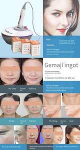 Appareil portable de <span class=keywords><strong>radiofréquence</strong></span> pour la réduction des rides, <span class=keywords><strong>radiofréquence</strong></span> fractionnée, <span class=keywords><strong>micro</strong></span>-<span class=keywords><strong>aiguilles</strong></span>, machine Vivace RF, <span class=keywords><strong>micro</strong></span>-<span class=keywords><strong>aiguilles</strong></span> pour lifting du visage - Product Image 4