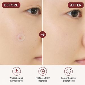 Patchs anti-acné en forme de cercle et étoile en gros, 12, 18, 20, 24, 36 points pour la peau - Product Image 5