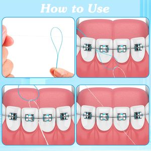 Enfile-fil dentaire pour le nettoyage des dents avec appareils orthodontiques, bridges, implants et dispositifs orthodontiques - Product Image 2