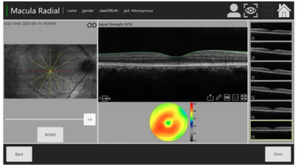 OCT-500 peralatan diagnostik pencitraan <span class=keywords><strong>Retinal</strong></span> presisi tinggi, pemindai tomografi moderen optik oftalik dengan garansi 1 tahun - Product Image 4