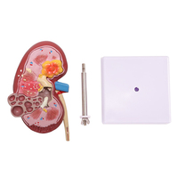 Modelo de Riñón Patológico y Normal - Simulación de Enseñanza de Urología, Modelo de Anatomía y Estructura del Riñón Humano