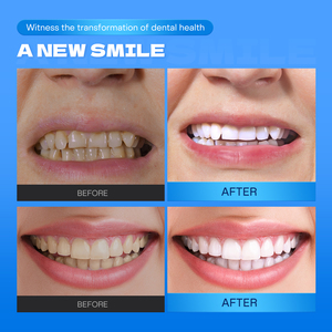 Siero Riparatore per Smalto Dentale con Logo Personalizzato, Lenitivo e Illuminante per Denti Sensibili, Liquido Protettivo per Cura Orale Quotidiana - Product Image 6