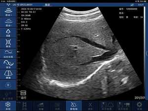 <span class=keywords><strong>Doppler</strong></span> Linear <span class=keywords><strong>Ultrasound</strong></span> warna Palm 7.5MHz/10MHz <span class=keywords><strong>Probe</strong></span> cembung Wifi konektivitas didukung untuk IOS Android Windows elektrik - Product Image 6