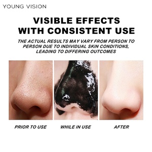 Mascarilla Líquida Nasal Negra Desprendible YOUNG VISION Nature Fácil de Usar, 50g, para el Cuidado Facial Diario, Fabricante Profesional - Product Image 4