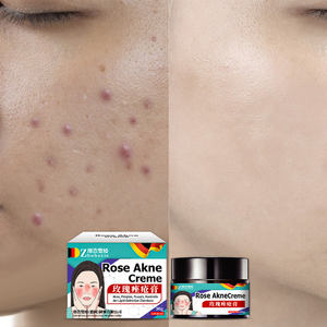 Crème de rosacée, assombrissement de l'acné, boutons, fosses d'acné, marques d'acné, crème, crème nettoyante - Product Image 3