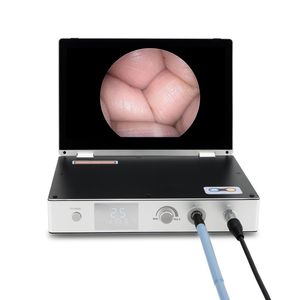 4 trong 1 nội soi Hệ thống camera với nguồn ánh sáng lạnh 11.6 inch màn hình cho hysteroscopy nội soi ổ bụng <span class=keywords><strong>arthroscopy</strong></span> sugery - Product Image 2