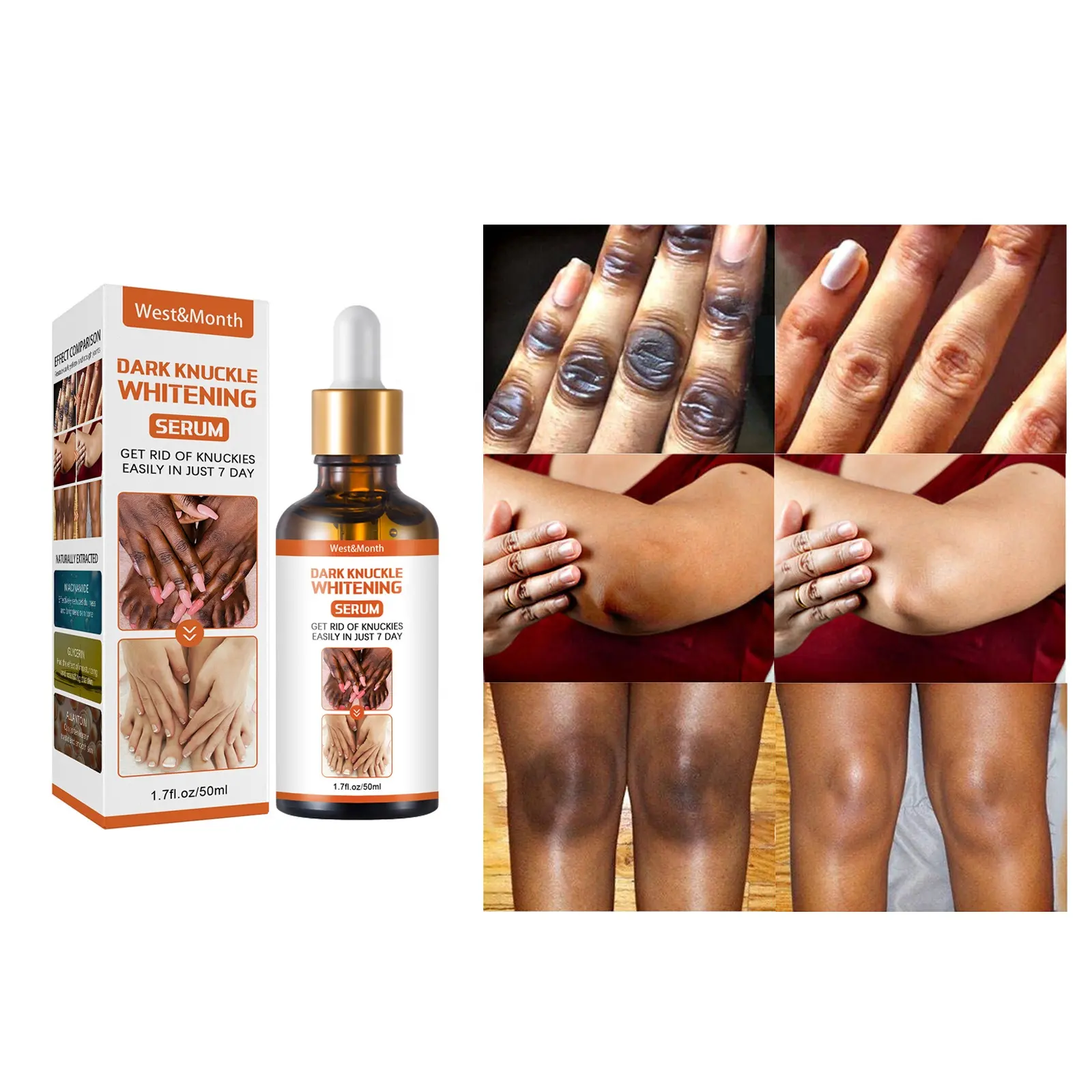 Joint de-blackening beauty serum to lighten melanin knee and ankle corner brighten skin tone moisturizing moisturizing skin reju