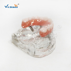 Modèle de Restauration d'Implant Maxillaire M6001-1, Structure de Prothèse Dentaire Démontable, Aide Pédagogique pour la Formation Dentaire - Product Image 5