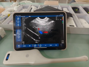 Dos Versiones de Sonda Endocavitaria Ginecológica Inalámbrica DMU92, Sonda de Ultrasonido Doppler Color para Diagnóstico Ginecológico Humano - Product Image 6
