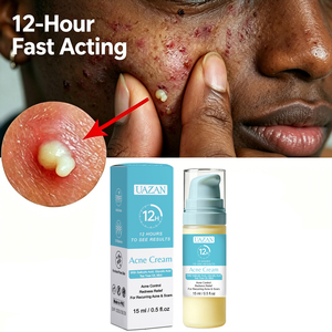 Crème <span class=keywords><strong>Visage</strong></span> Anti-Acné à l'Acide Salicylique, Réparation Rapide et Efficace des Cicatrices d'Acné, Élimination des Taches, Resserre les Pores, Marque Privée - Product Image 1