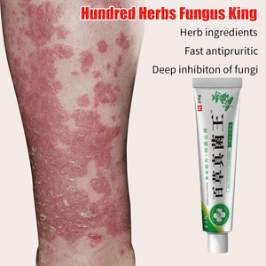 SmmlpunHerbal King Crema para picazón <span class=keywords><strong>tiña</strong></span> hidratante toxina pomada antibacteriana externa venta al por mayor cuidado de la piel del pie - Product Image 4