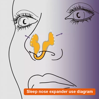 Dilatateurs nasaux en silicone de qualité médicale personnalisés, anti-ronflement, pince nasale en silicone pour améliorer le sommeil et corriger la respiration