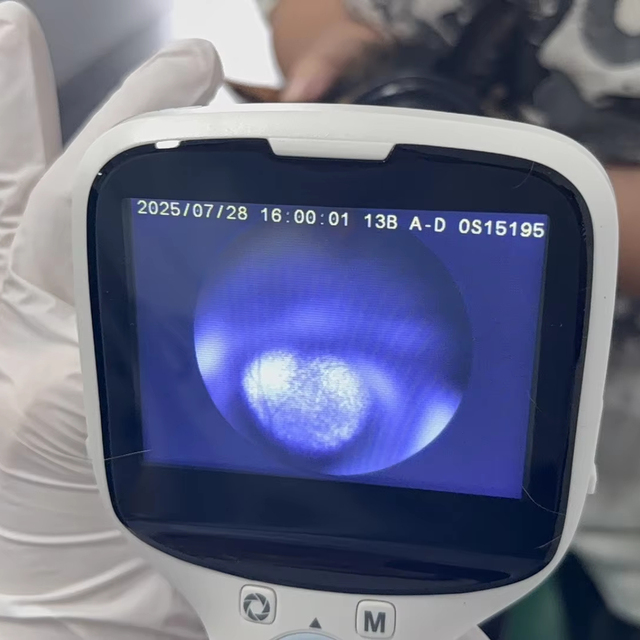 Portable Non-mydriactic Ophthalmic Fundus Camera Veterinary Retinal Camera Non-dialated Digital Fundus Camera for Human