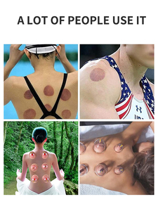 Produits en gros les plus vendus 2025 – Offre Spéciale : Kit de ventouses jetables pour thérapie Hijama à la médecine traditionnelle chinoise - Product Image 2