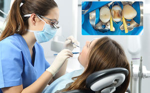 Sj Chất <span class=keywords><strong>L</strong></span>ượng Cao Nha Khoa Chất Liệu Dùng Một <span class=keywords><strong>L</strong></span>ần Màu Xanh <span class=keywords><strong>L</strong></span>á Cây Tam Giác Răng Nêm Hướng Dẫn Sử Dụng Cho Bằng Miệng Phụ Trợ Đúc Tấm Phù Hợp Răng - Product Image 4