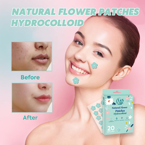 20 Parches <span class=keywords><strong>para</strong></span> el Acné con Forma de Flor Colorida, Nueva Forma, Parche Anti-Acné, 12 mm con Perla - Product Image 4