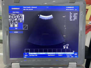 <span class=keywords><strong>Excellent</strong></span> appareil d'échographie vétérinaire numérique portable 3D 4D pour la grossesse vétérinaire - Product Image 6