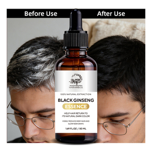 เซรั่มบำรุงผมขาวเปลี่ยนเป็นดำ ปิดผมขาวเป็นธรรมชาติ สำหรับผู้ชายและผู้หญิง ขายส่ง - Product Image 1