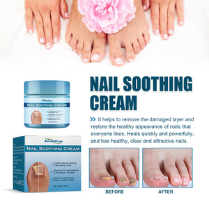 Crème nourrissante et fortifiante pour ongles South <span class=keywords><strong>Moon</strong></span> Natural Nails, anti-fongique, restaure la santé des ongles, à base de plantes - Product Image 3