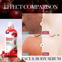 Oem Sadoer Private Label Cherry Fruit Acid Essence Voor Het Voeden Van Hydraterende Gladde Gezichtsverzorging